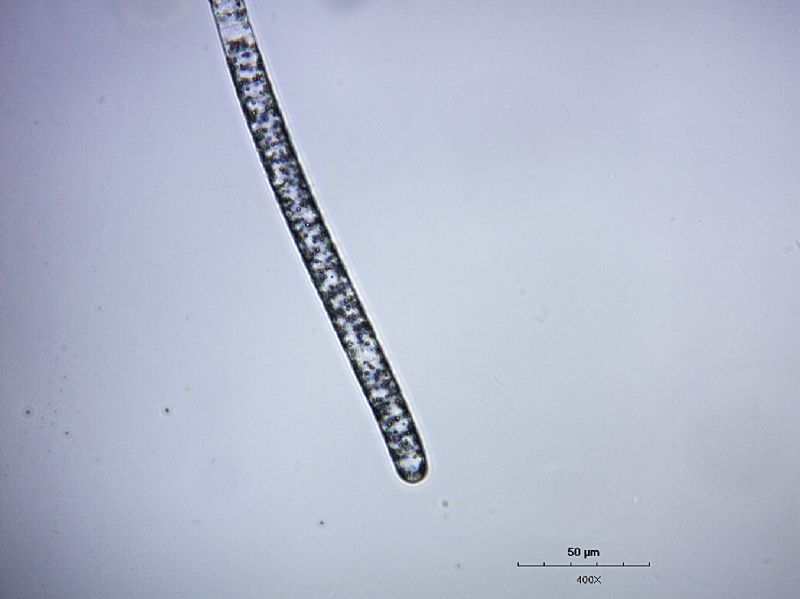 Beggiatoa sp. (solfobatterio)